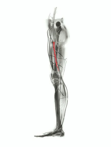 Arterial Leg Diseases